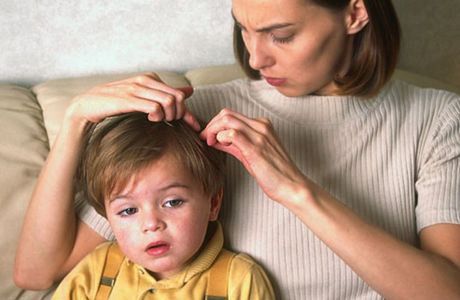 Как лечить вши - лечение вшей у детей и беременных